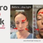 aduro LED mask trial review