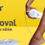 IPL devices for dark skin